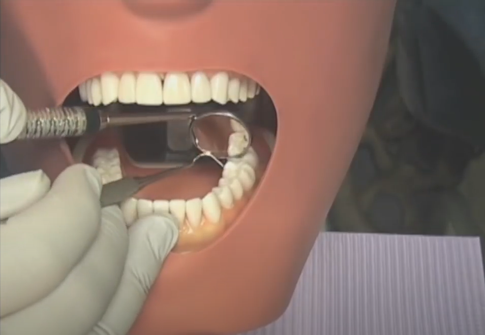 GMAX Hands On University Curriculum Overview – Turnkey Dental Assistant School Call 1(800) 906.0954